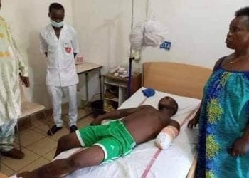 Le jeune Parfait Djontenou Talla, élève au lycée technique de Njombe a été délesté d'une partie de son bras gauche à la suite d'une violente bagarre.