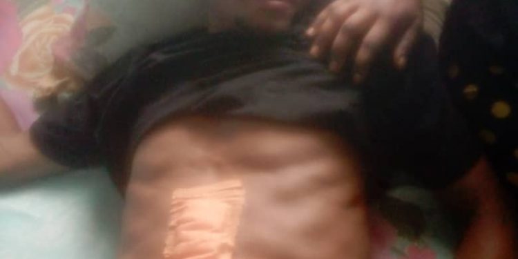 Young Security guard stabbed in buea