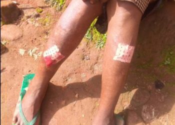 Separatists attack elderly women