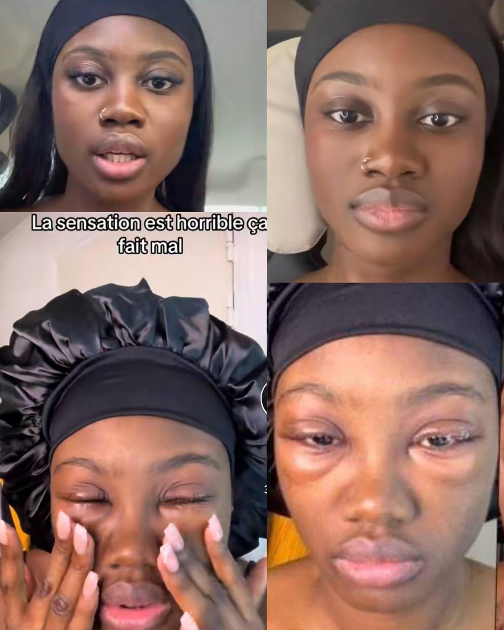 Lady advices others against the use of fake eyelashes