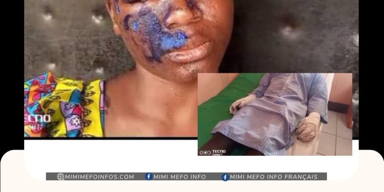 Woman arrested for pouring hot oil on boyfriend