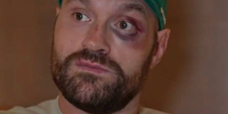 The Gypsy King, Tyson Fury will not be ready for his fight in December