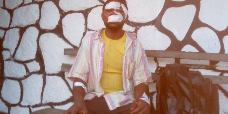 Wood Cutter Survives Chimpanzee Attack, source: Cameroon Infotrend