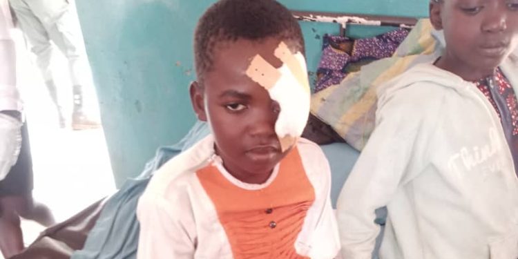 Nkambe 11 February attack