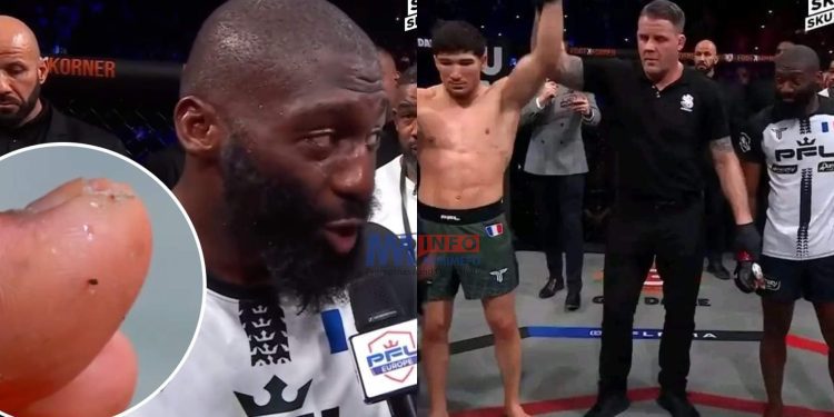 Pourquoi Cédric Doumbé a perdu par TKO