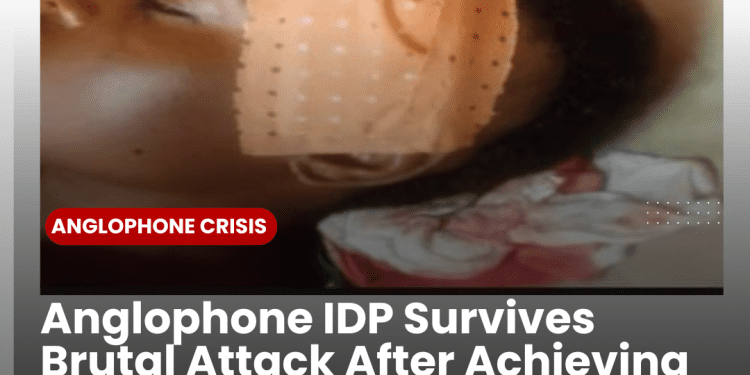 Anglophone IDP survives attack