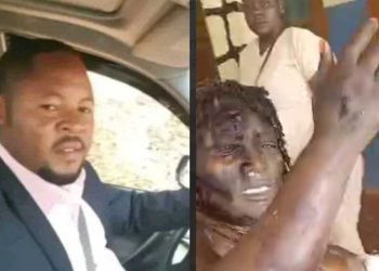 Man pours acid on the wife Bamenda