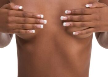 Breast Cancer in Cameroon