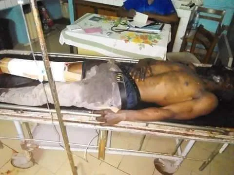 Bomb Victim 1