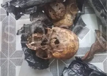 Ngaoundéré: Des ossements humains saisis