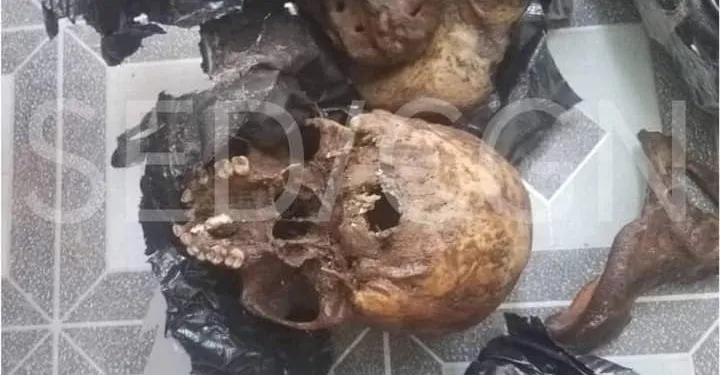 Ngaoundéré: Des ossements humains saisis