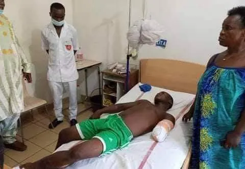 Le jeune Parfait Djontenou Talla, élève au lycée technique de Njombe a été délesté d'une partie de son bras gauche à la suite d'une violente bagarre.