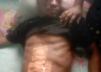 Young Security guard stabbed in buea