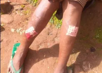 Separatists attack elderly women