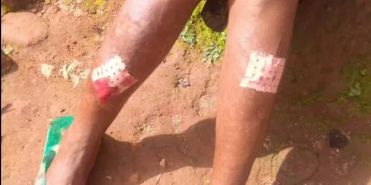 Separatists attack elderly women