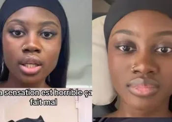 Lady advices others against the use of fake eyelashes