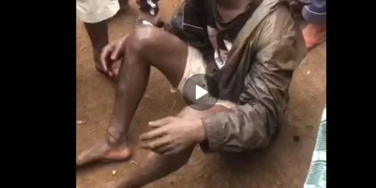 Man Escapes death after been lynched by an angry mop this morning. Mop justice cameroon