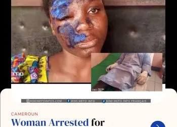 Woman arrested for pouring hot oil on boyfriend