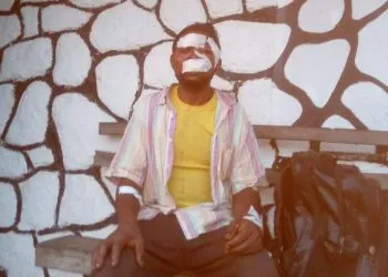 Wood Cutter Survives Chimpanzee Attack, source: Cameroon Infotrend