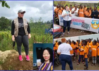 MMI Joins Longla to celebrate World Albinism Day