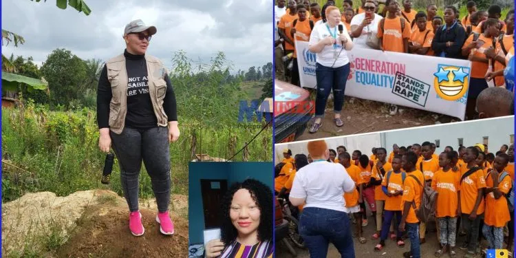 MMI Joins Longla to celebrate World Albinism Day