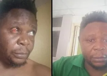 Cameroonian activist unlawfully arrested and tortured by Nigerian police
