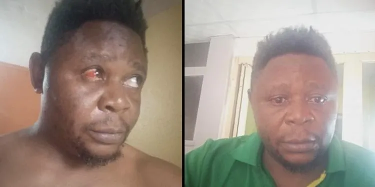 Cameroonian activist unlawfully arrested and tortured by Nigerian police