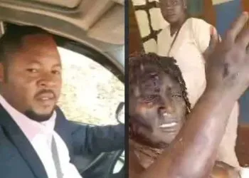 Man pours acid on the wife Bamenda