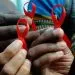 HIV