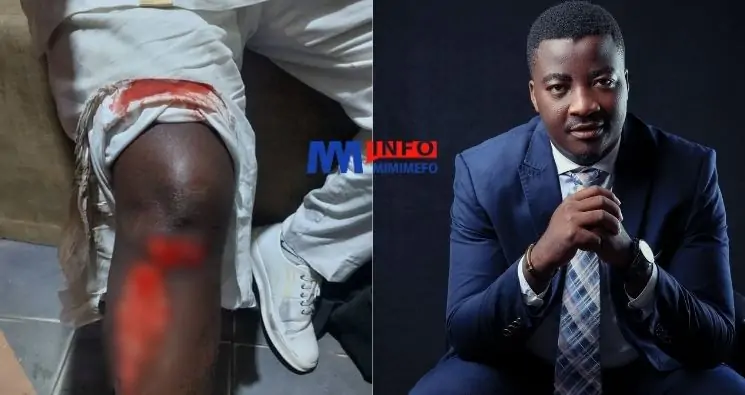 Le journaliste Romaric Tenda échappe à une agression à main armée dans un taxi à Douala